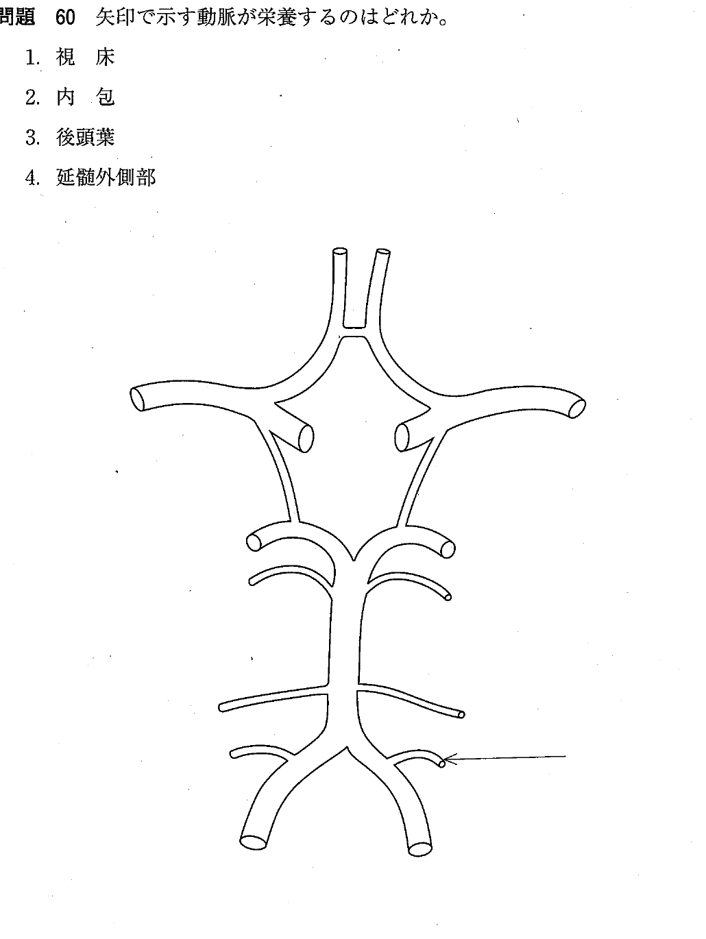 第28回 問60 の図 1