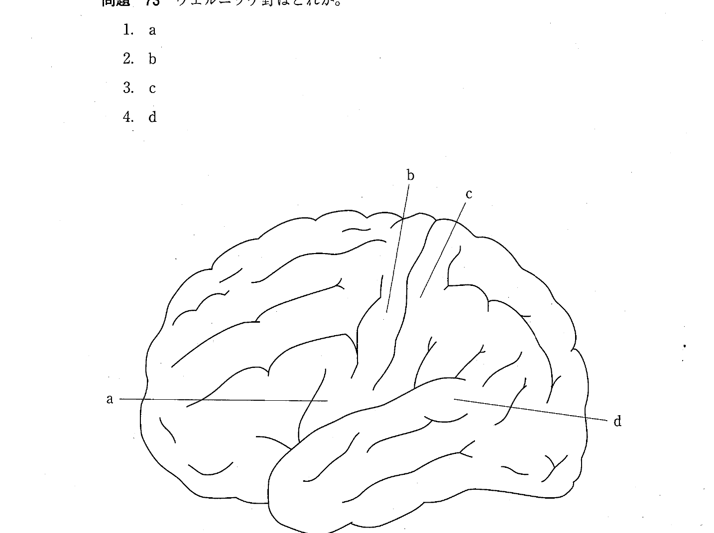 第28回 問73 の図 1
