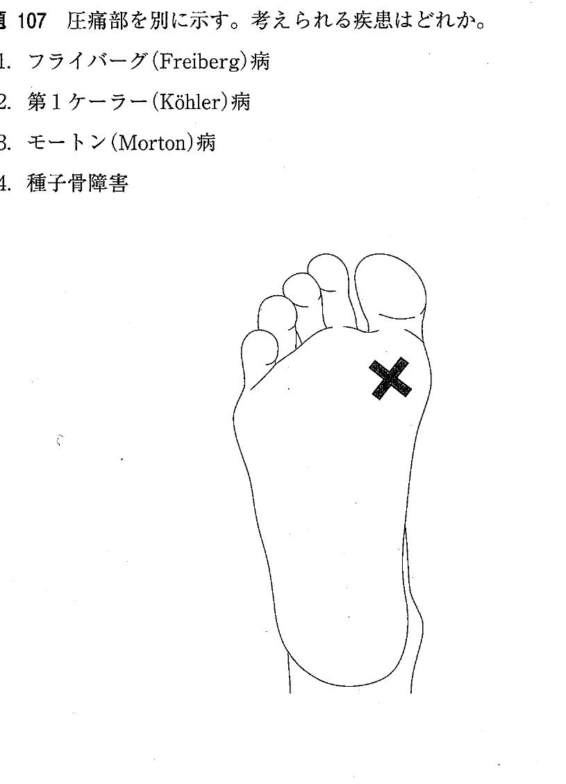 第28回 問235 の図 1