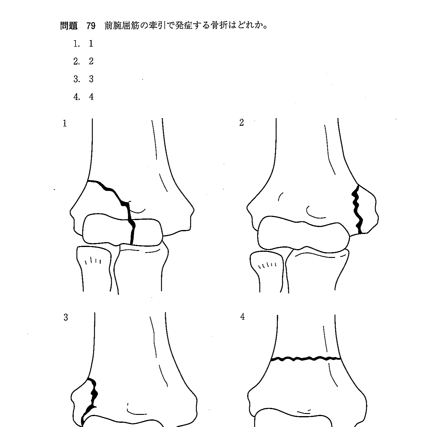 第30回 問207 の図 1