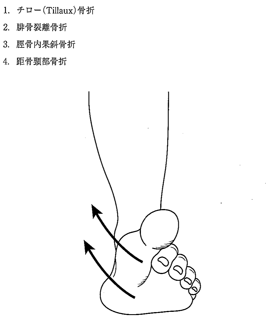 第30回 問214 の図 1