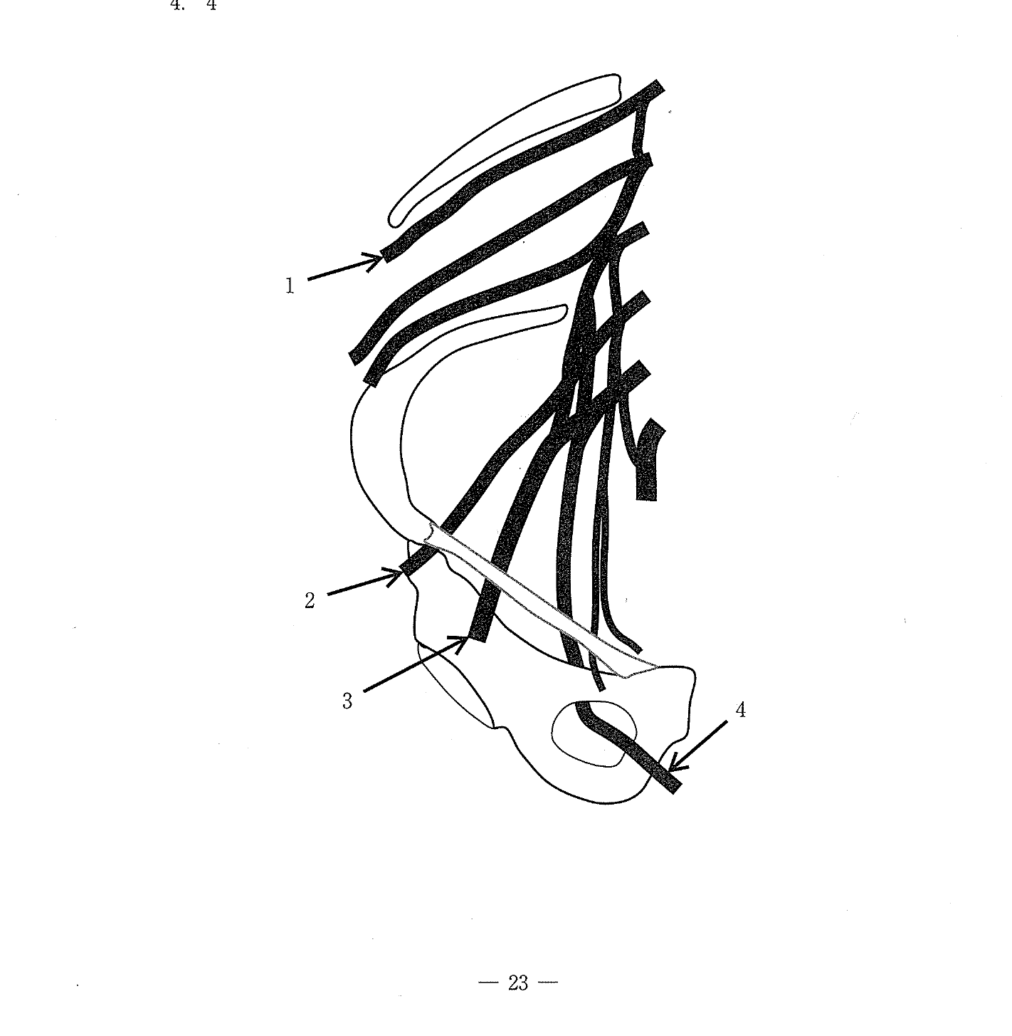 第31回 問75 の図 1