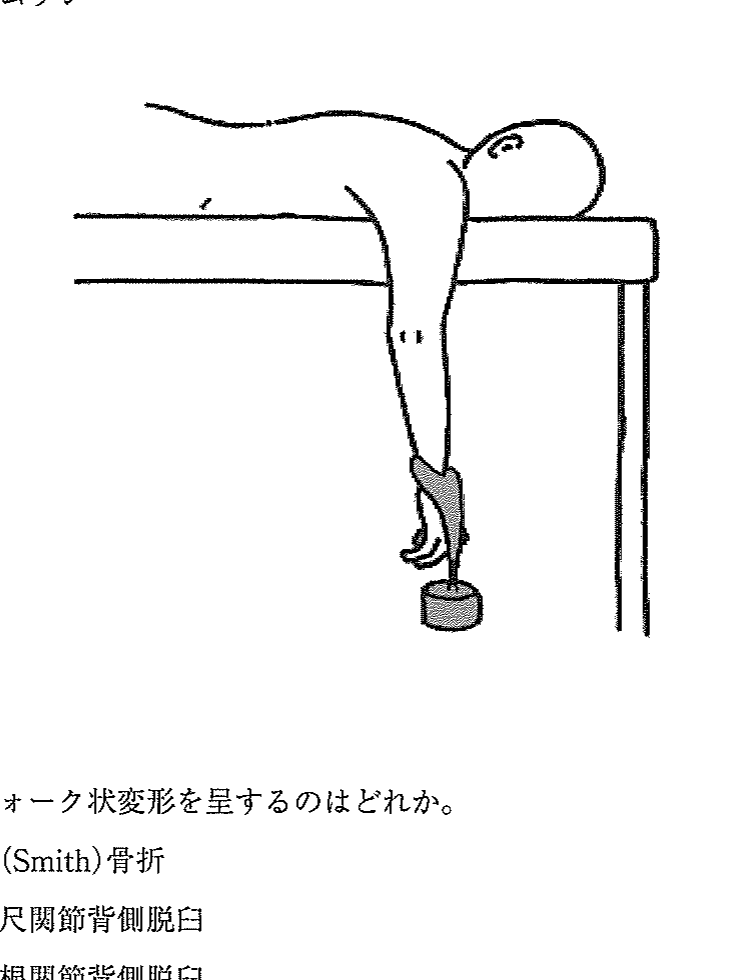 第33回 問215 の図 1